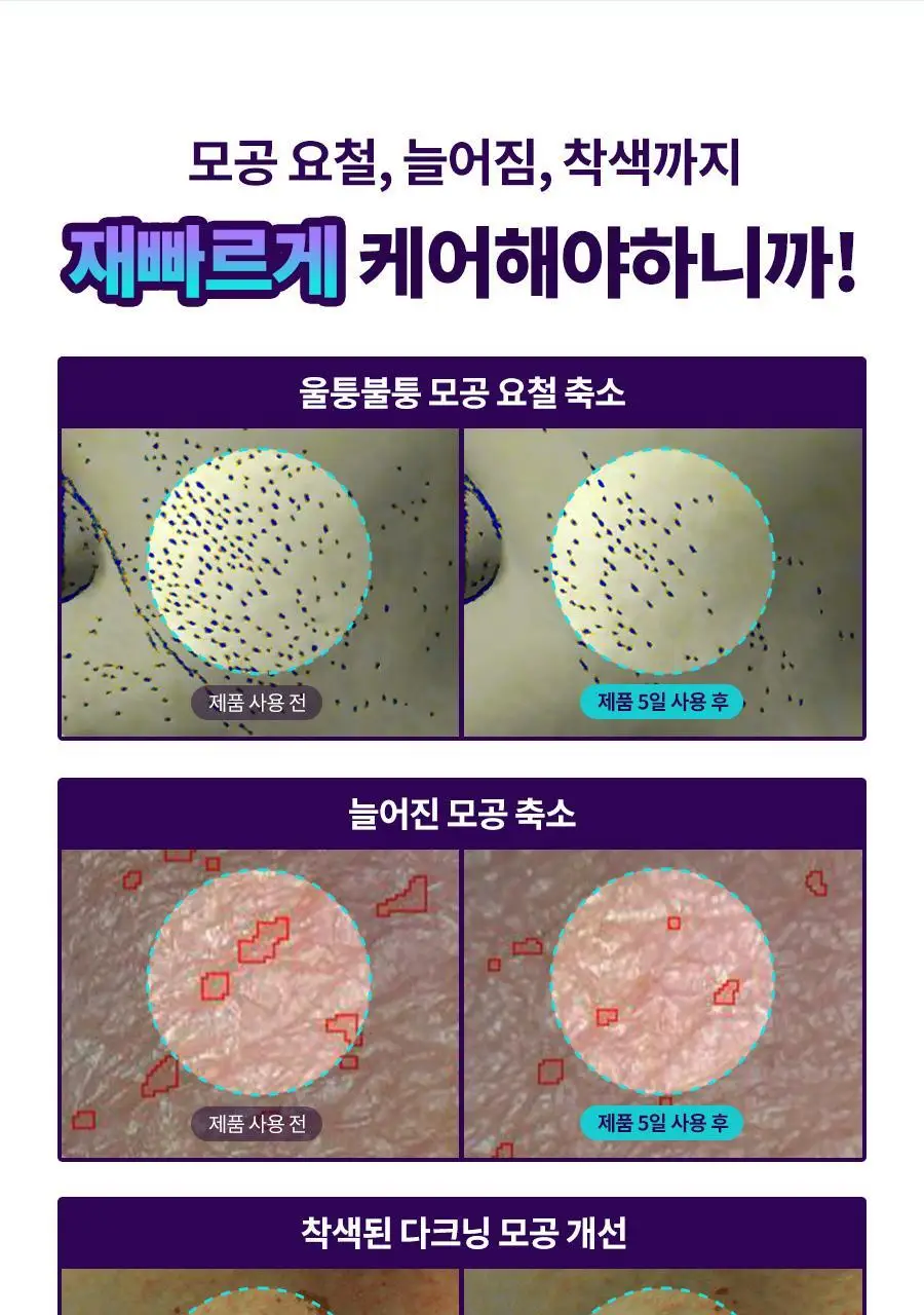 [모공케어/피부결] 닥터지 바쿠치올 포어젯 세럼 30ml 기획 (+포어젯 스피큘 패드 2매 증정) 상세페이지 11
